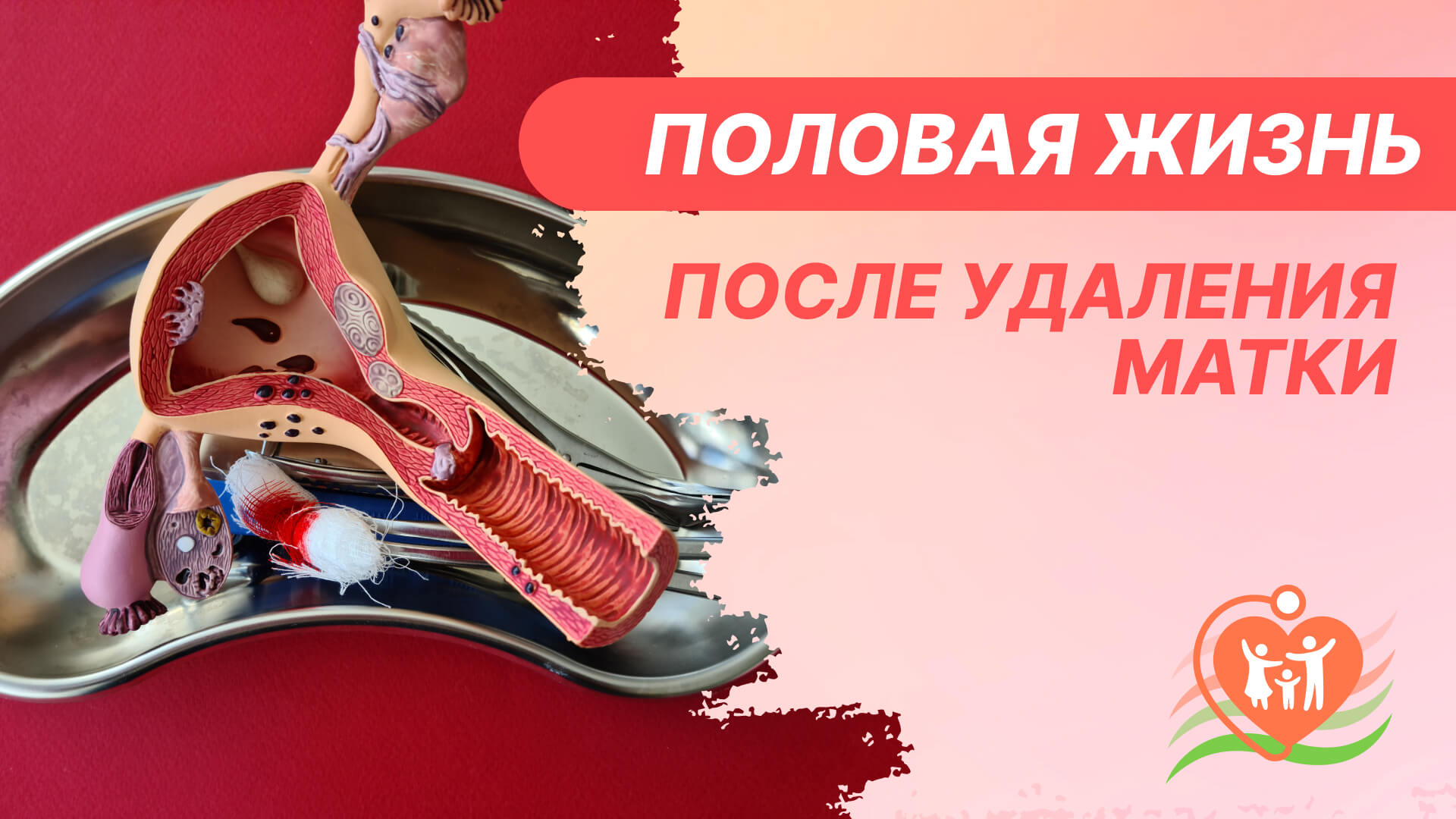 Занятие Сексом При Миоме