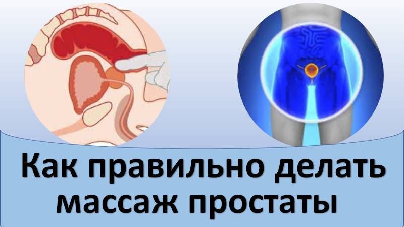 Какой Секс При Простатите